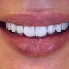 dental_lab3