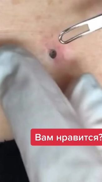 TikTok video thumbnail by doc.polner