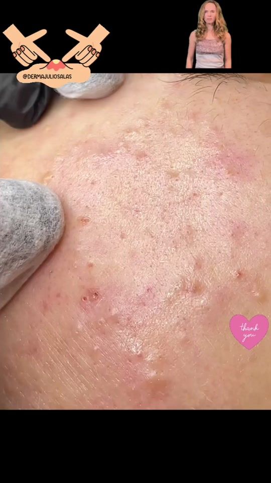 TikTok video thumbnail by innussik
