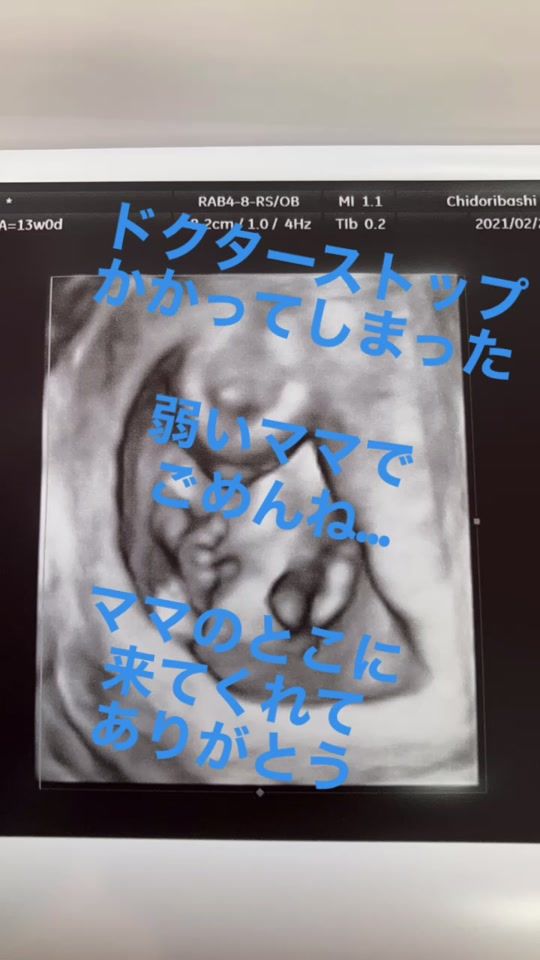 TikTok video thumbnail by hdjgdgbd
