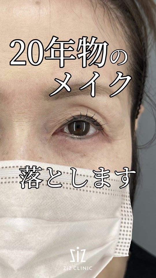 TikTok video thumbnail by zizclinic