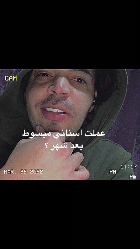 TikTok video thumbnail by aboudothman11