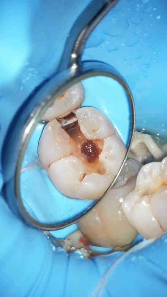TikTok video thumbnail by dr.uchiyama