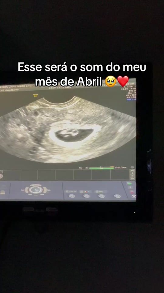TikTok video thumbnail by jaineebres