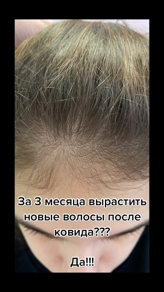 TikTok video thumbnail by dr.emiheeva