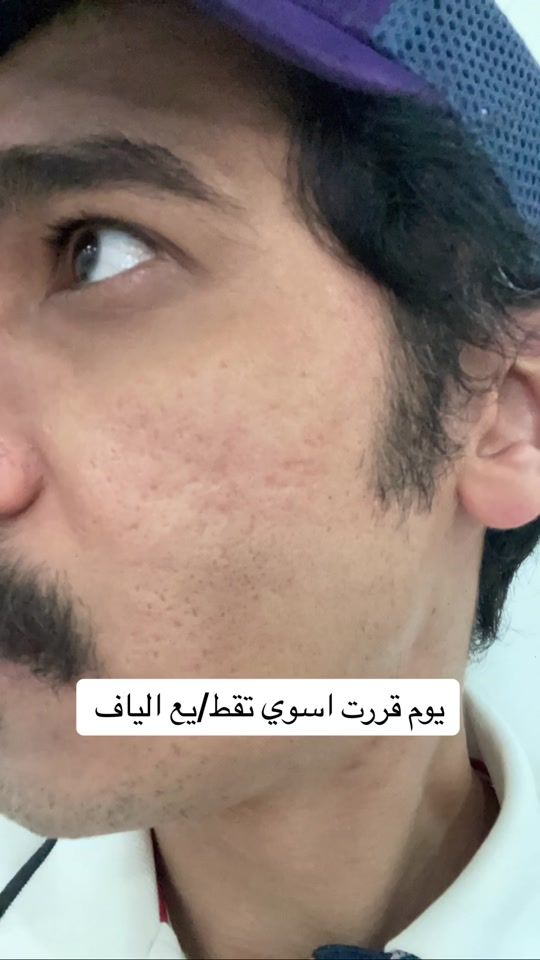 TikTok video thumbnail by ahmedalhelli1