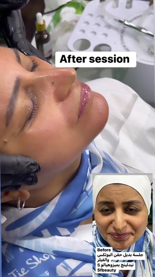TikTok video thumbnail by rara.nabih