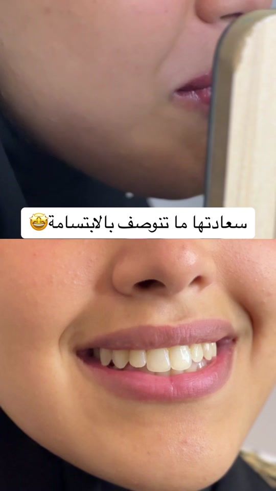 TikTok video thumbnail by albaclinics