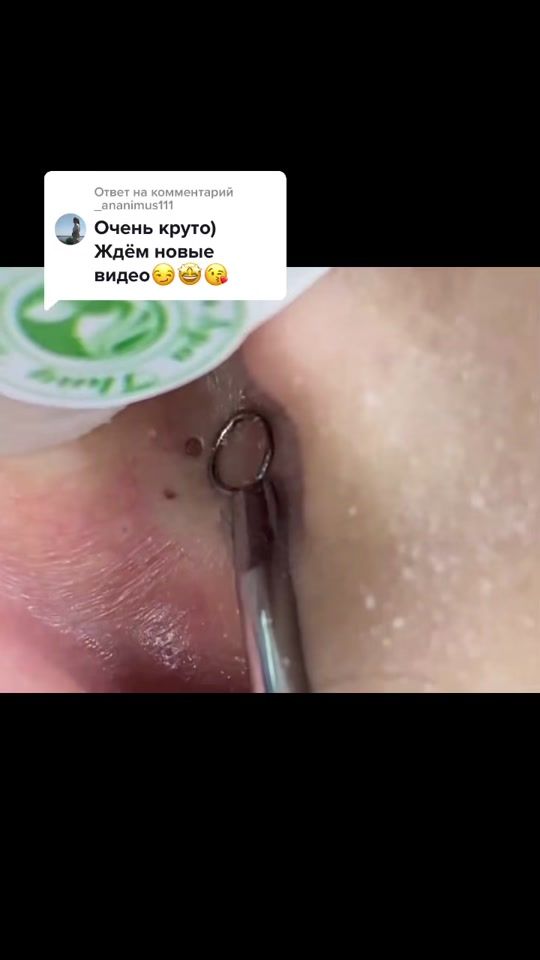 TikTok video thumbnail by disgustingsatisfaction