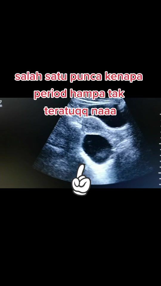 TikTok video thumbnail by drfatinamirahazwani_md