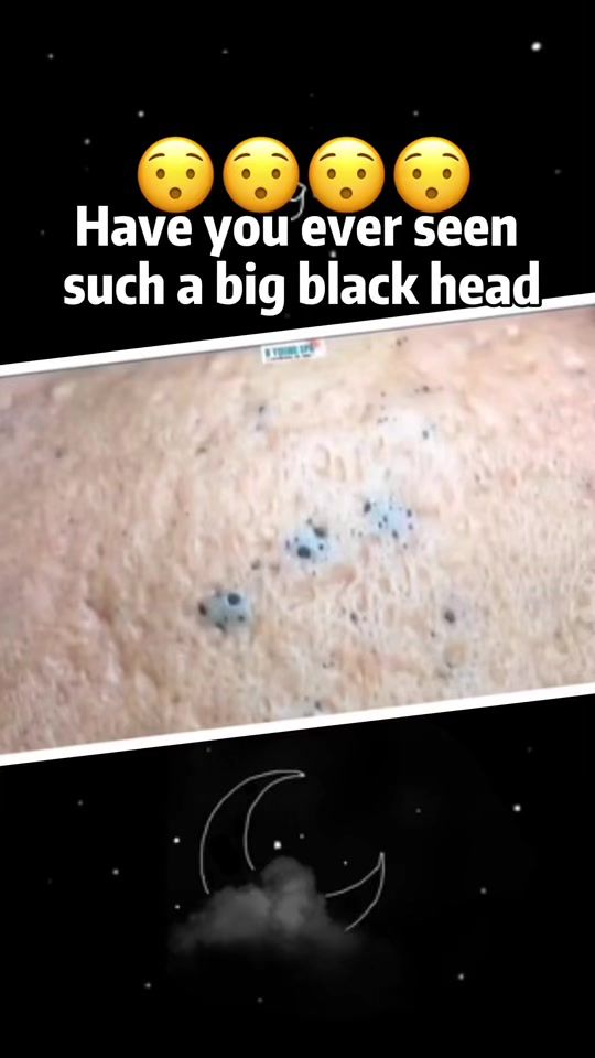 TikTok video thumbnail by svtdocto