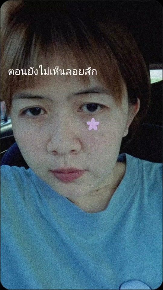 TikTok video thumbnail by aun_aun1106