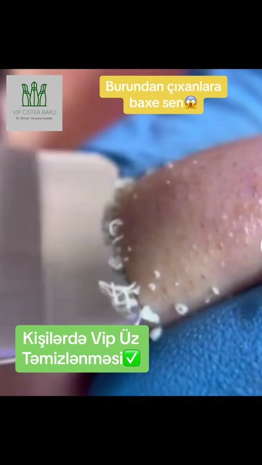 TikTok video thumbnail by dr.nicathuseyn