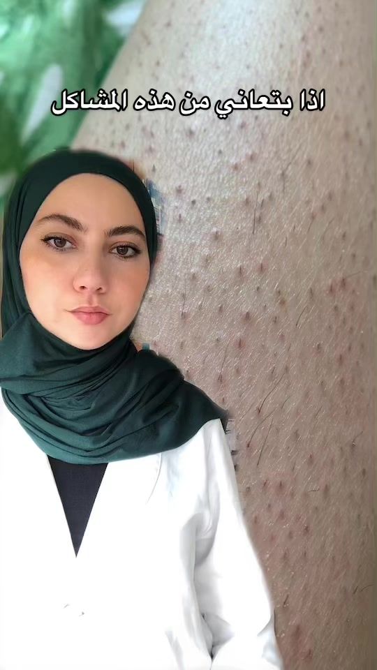 TikTok video thumbnail by pharmacistmeerna