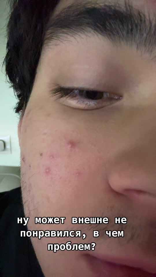 TikTok video thumbnail by azeeeeeeeeka