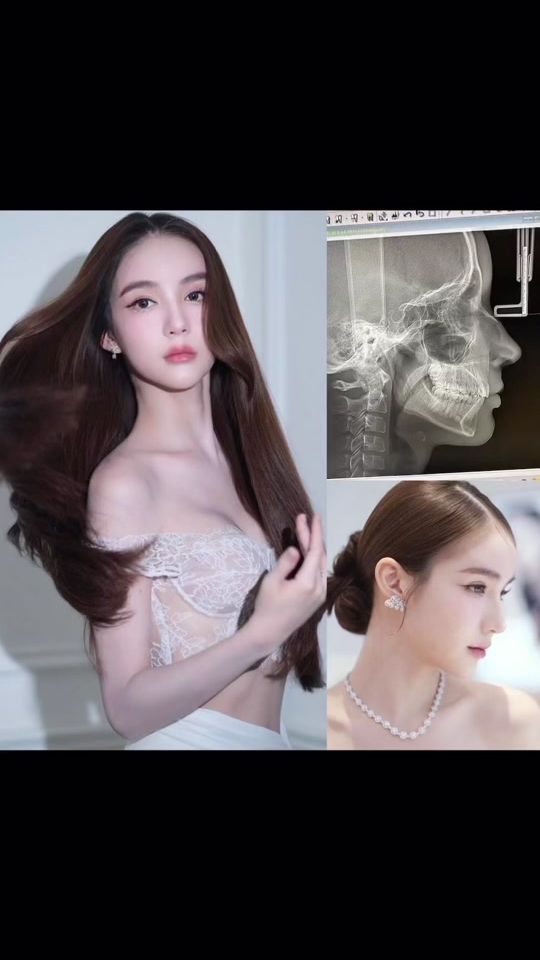 TikTok video thumbnail by smileupdent