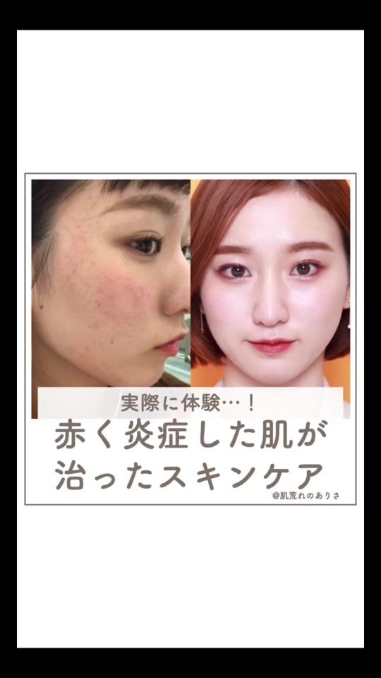 TikTok video thumbnail by ohada_arisa