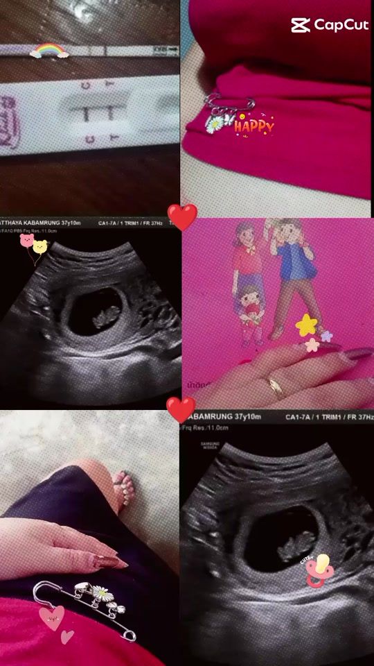 TikTok video thumbnail by tonchaw24