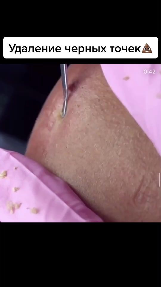 TikTok video thumbnail by merzkoetv