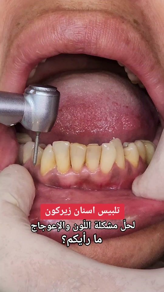 TikTok video thumbnail by dreliegemaa