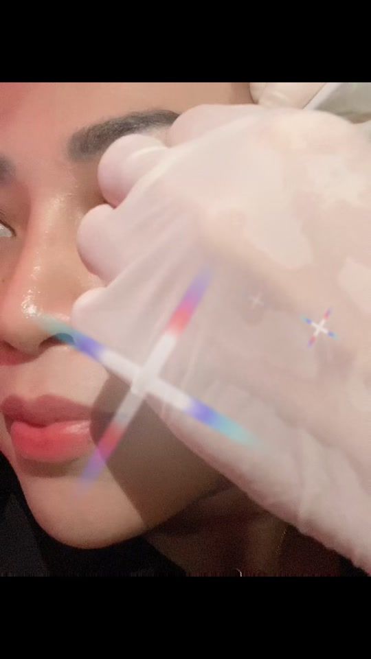 TikTok video thumbnail by febydental