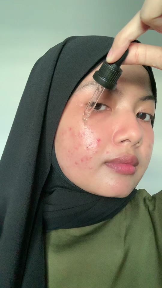 TikTok video thumbnail by nshnlle