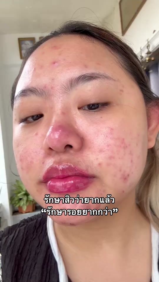 TikTok video thumbnail by nuttykoala123