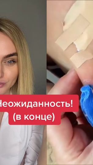 TikTok video thumbnail by doc.polner