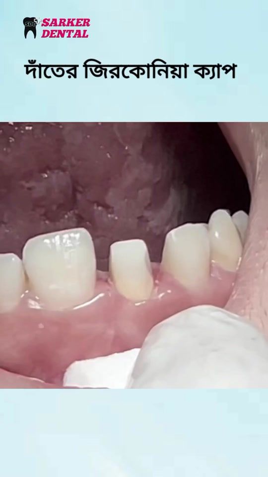 TikTok video thumbnail by dr.moniruzzaman_sarker