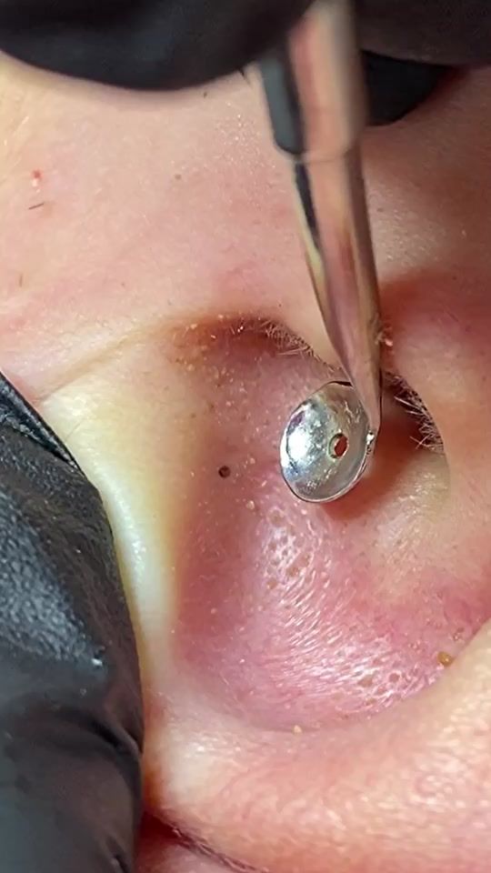 TikTok video thumbnail by cosmetolog_26_15