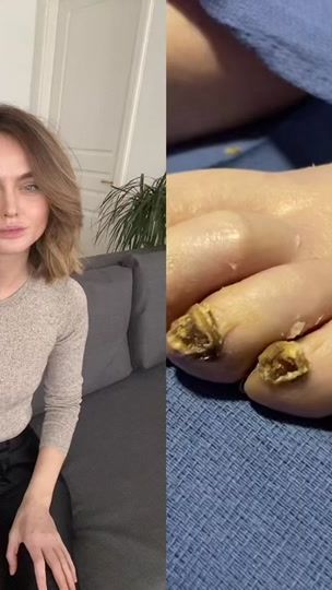 TikTok video thumbnail by doc.polner