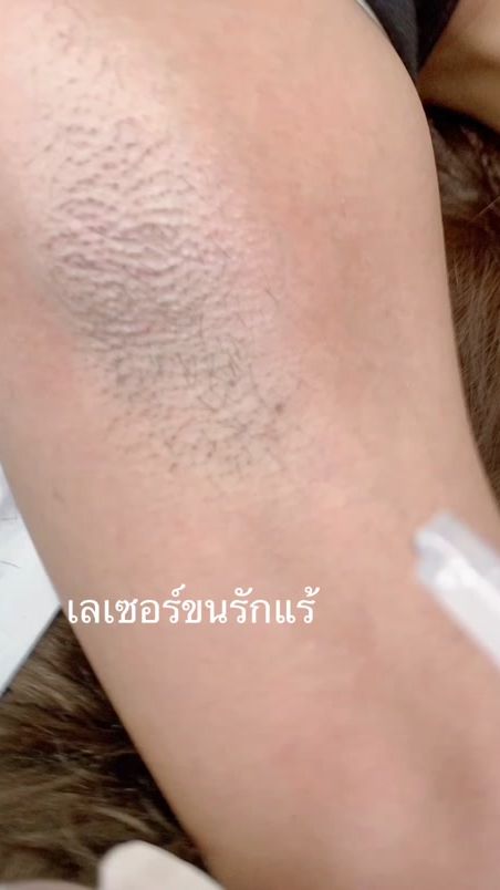 TikTok video thumbnail by saifoneyebrow