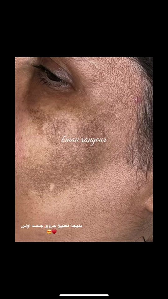 TikTok video thumbnail by emansanyor