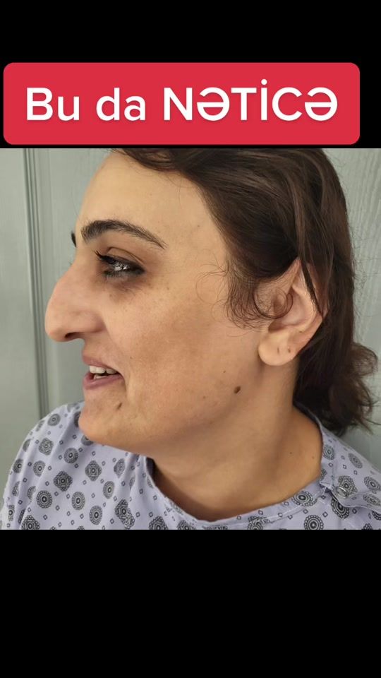 TikTok video thumbnail by dr.demircalov_rafiq