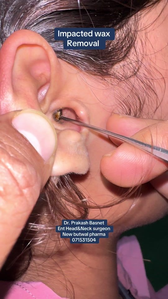 TikTok video thumbnail by dr.prakashbasnet