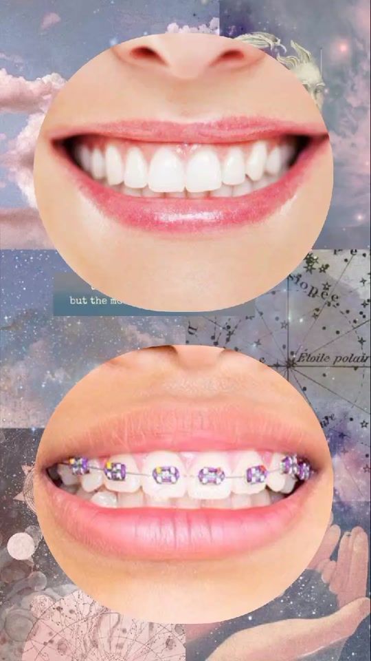 TikTok video thumbnail by vsssssss4