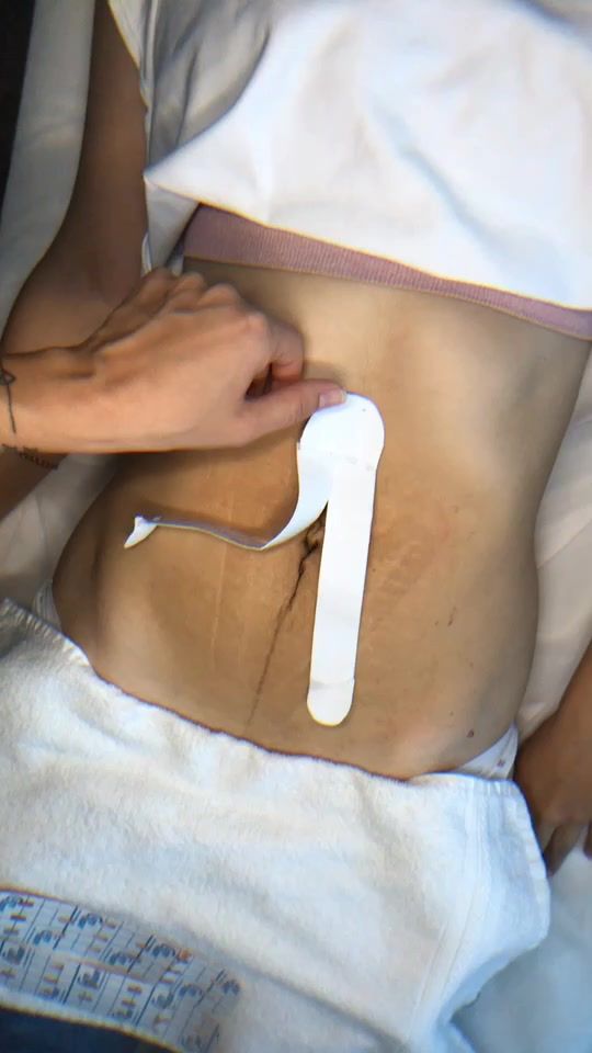 TikTok video thumbnail by kat_cosmetolog