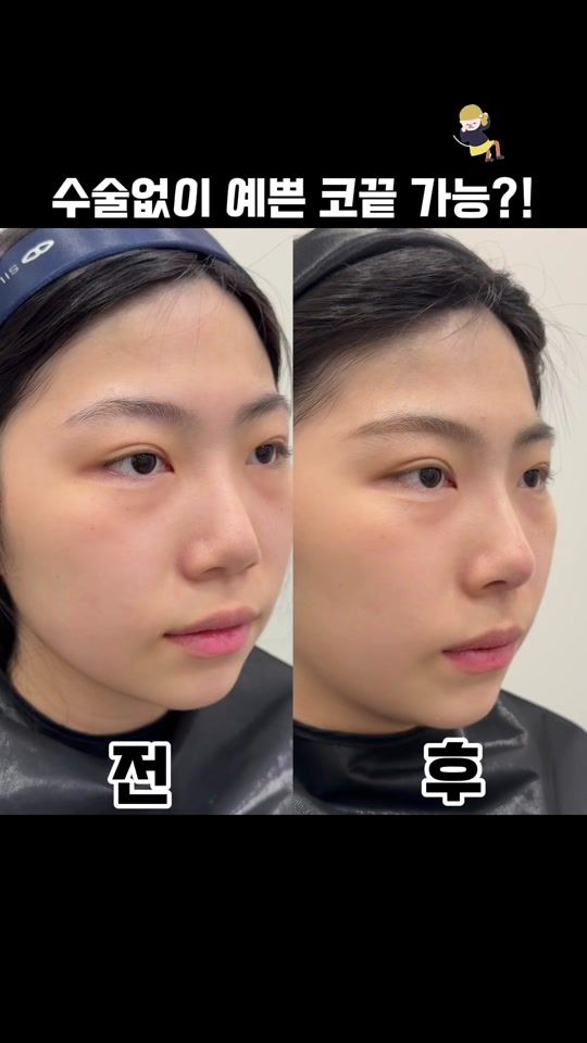 TikTok video thumbnail by yunwonseok