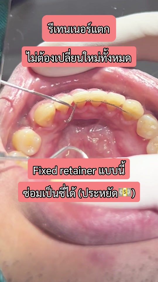 TikTok video thumbnail by drjessie_