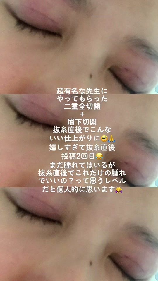 TikTok video thumbnail by hutae01