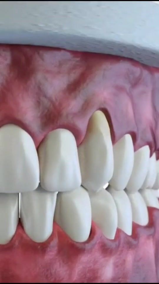 TikTok video thumbnail by nepalidentist