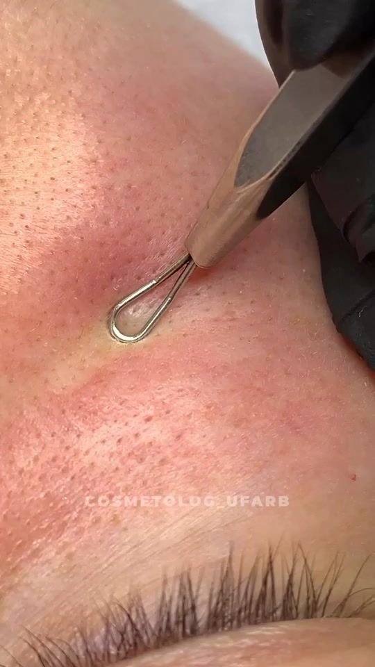 TikTok video thumbnail by cosmetolog_ufarb