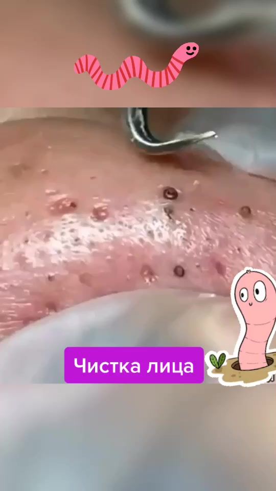 TikTok video thumbnail by drbotox