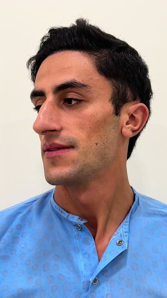 TikTok video thumbnail by dr_sanan_mehdiyev