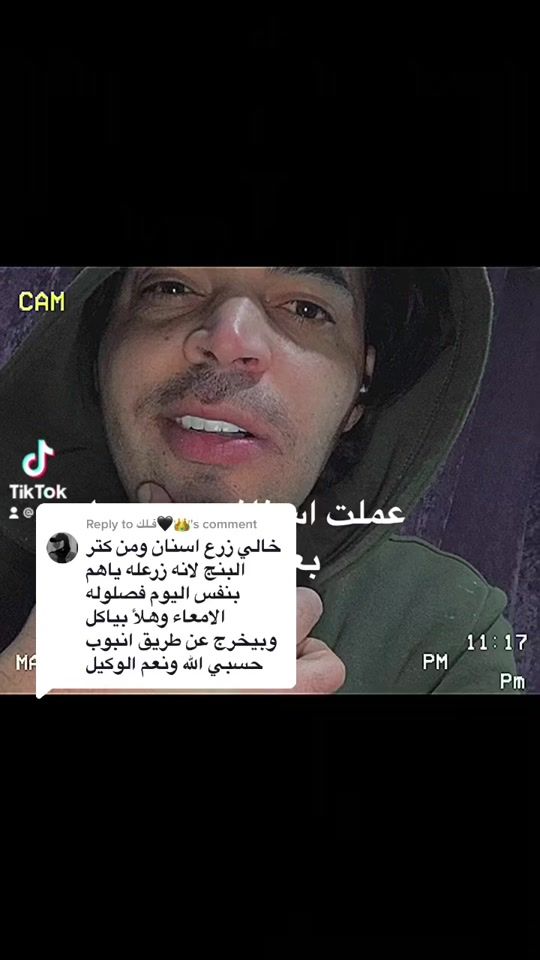 TikTok video thumbnail by aboudothman11