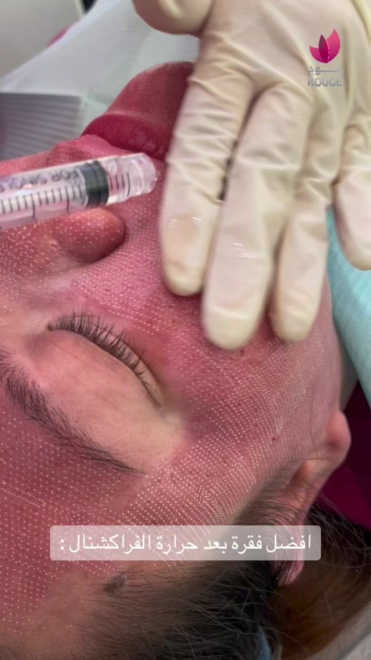 TikTok video thumbnail by rouge_clinic