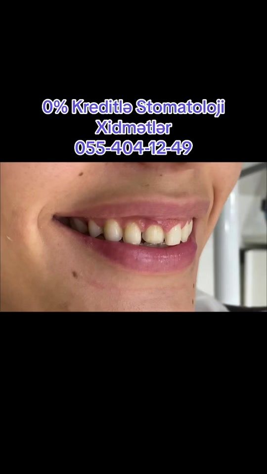 TikTok video thumbnail by estetic_dental