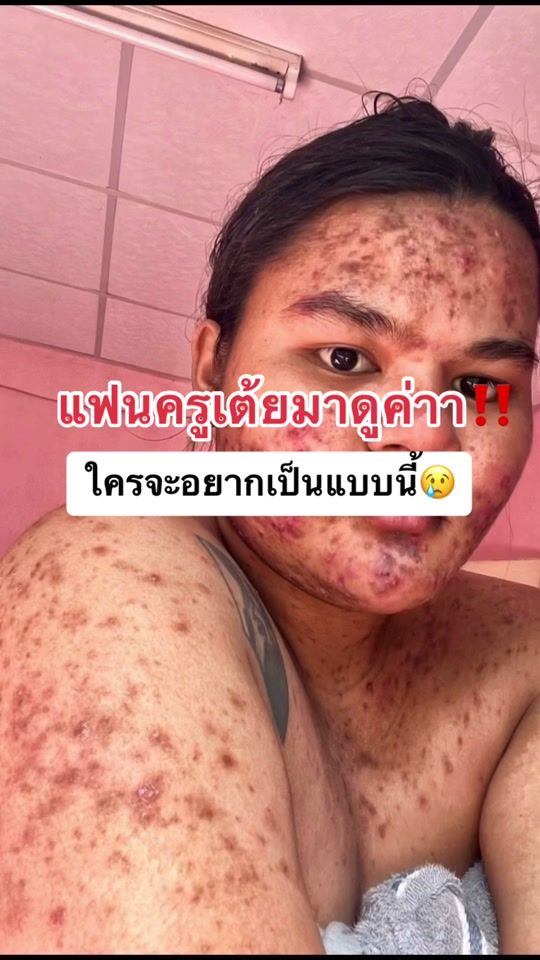 TikTok video thumbnail by khunwa