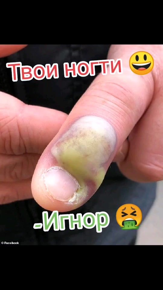 TikTok video thumbnail by sh_kipe_r