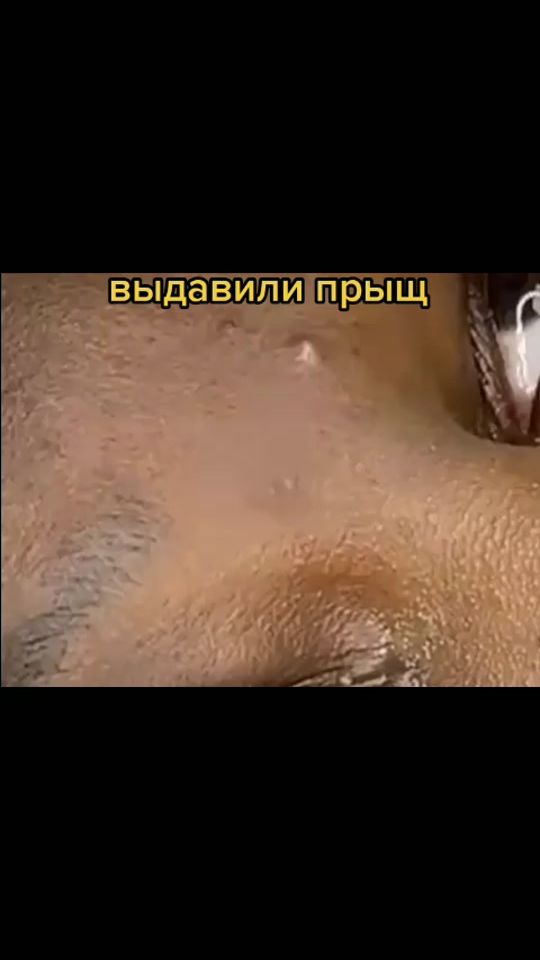 TikTok video thumbnail by pimplepus